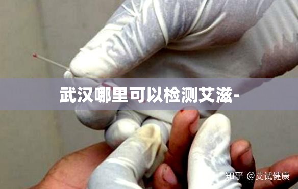 武汉哪里可以检测艾滋-