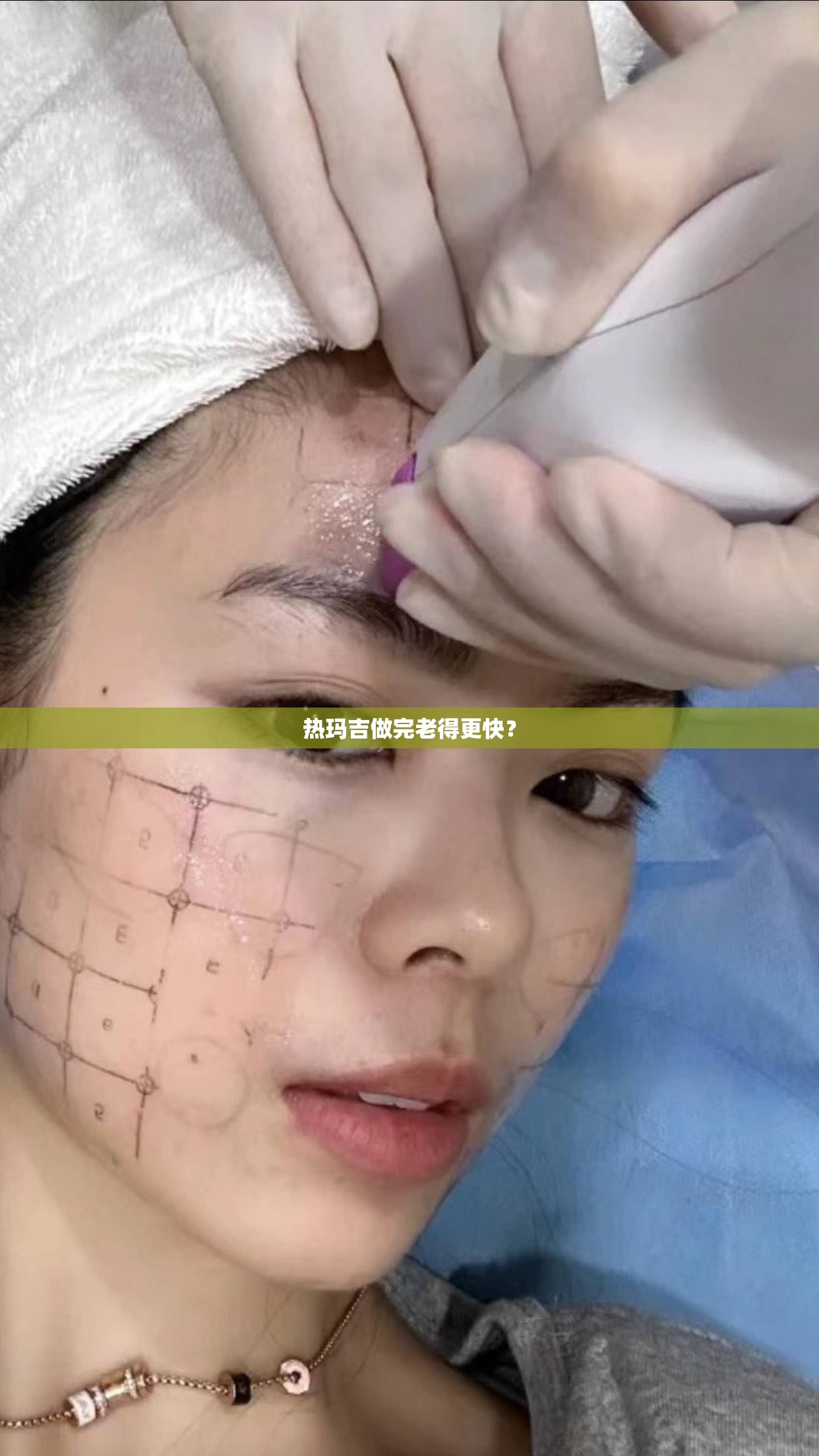 热玛吉做完老得更快? 热玛吉做完老得更快?